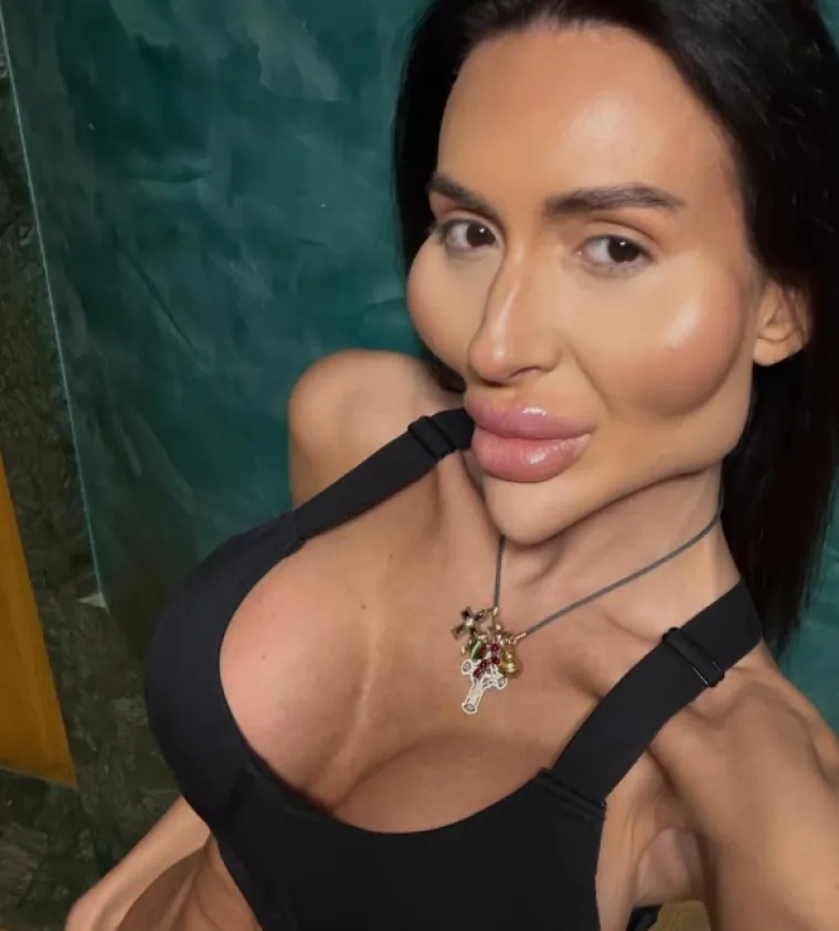 Ponosno nosi titulu žene s najvećim obrazima: Prije je bila prava ljepotica, evo kako je izgledala