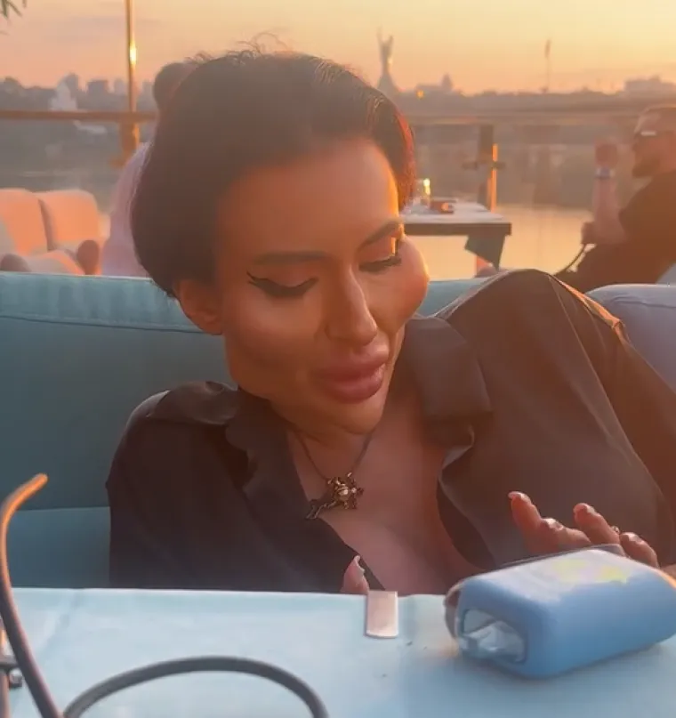 Ponosno nosi titulu žene s najvećim obrazima: Prije je bila prava ljepotica, evo kako je izgledala