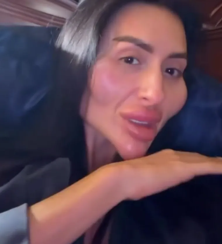 Ponosno nosi titulu žene s najvećim obrazima: Prije je bila prava ljepotica, evo kako je izgledala