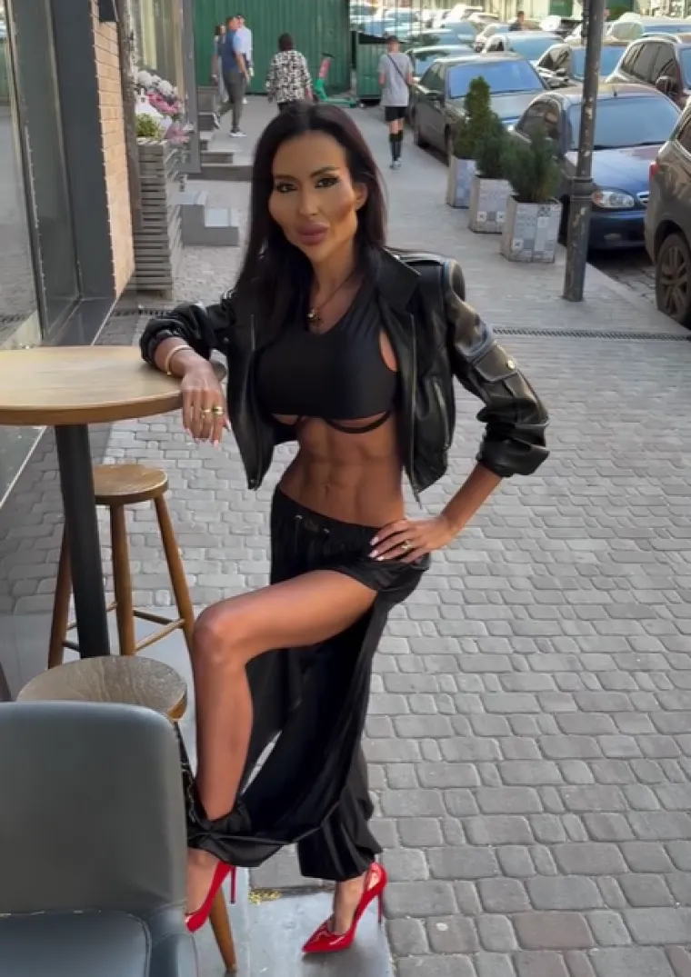 Ponosno nosi titulu žene s najvećim obrazima: Prije je bila prava ljepotica, evo kako je izgledala