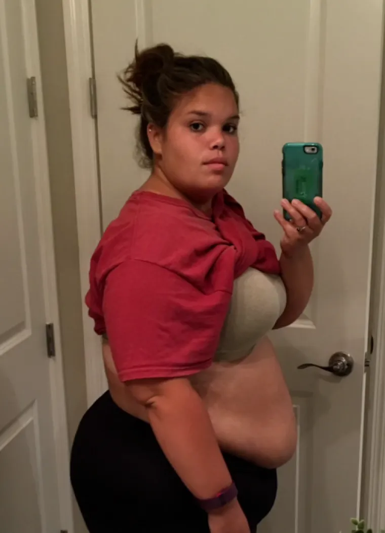 Sa samo 20 godina težila je 145 kilograma, no izokrenula je navike i danas je neprepoznatljiva