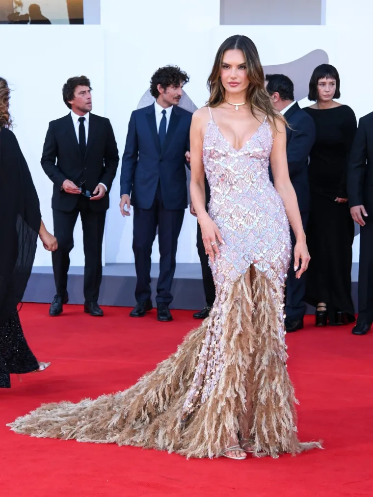 S 11 imala estetsku operaciju, pa postala slavna anđelica: Danas slavi 45., a ni traga godinama