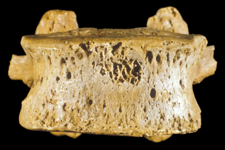 Budućnost će ovisiti o najhrabrijima: Dugotrajni boravak u svemiru ima 17 posljedica