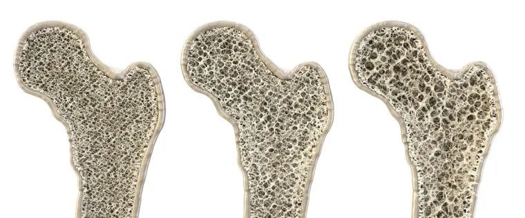 Budućnost će ovisiti o najhrabrijima: Dugotrajni boravak u svemiru ima 17 posljedica