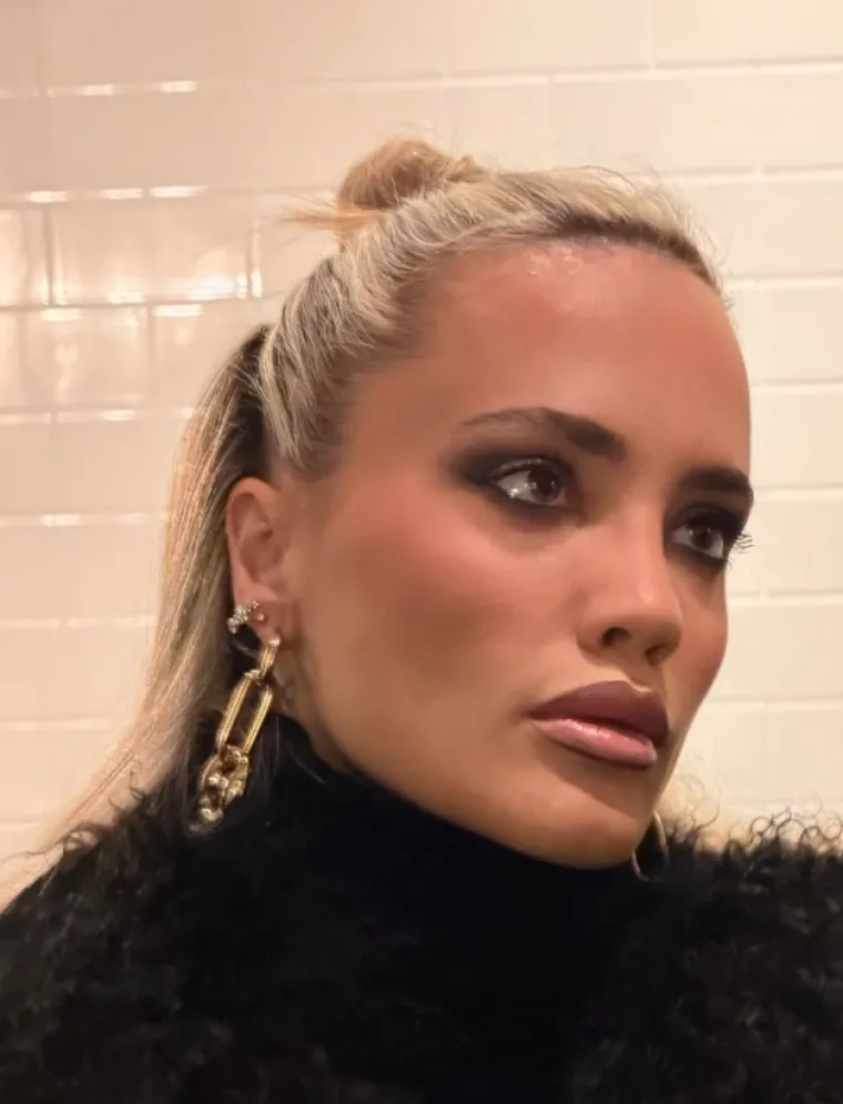 Ona je IT djevojka: Meri Golda&scaron;ić ne skriva operacije, a njezin razvod bio je glavna tema nacije