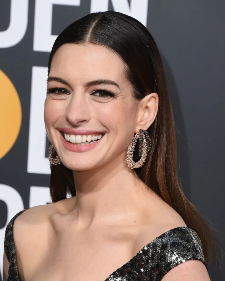 Progla&scaron;ena je najljep&scaron;om ženom svijeta, a kritiziraju je da se posve 'izobličila'