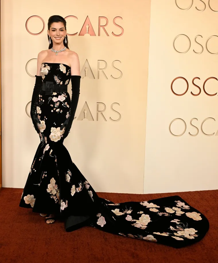 Progla&scaron;ena je najljep&scaron;om ženom svijeta, a kritiziraju je da se posve 'izobličila'