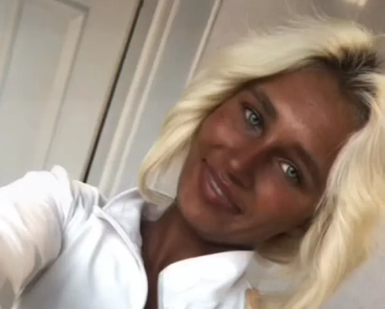 Ovisna je o solariju do te mjere da si je unakazila kožu, a ba&scaron; je bila slatka djevojka