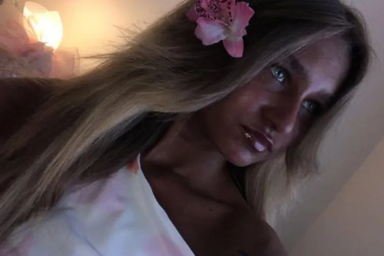 Ovisna je o solariju do te mjere da si je unakazila kožu, a ba&scaron; je bila slatka djevojka