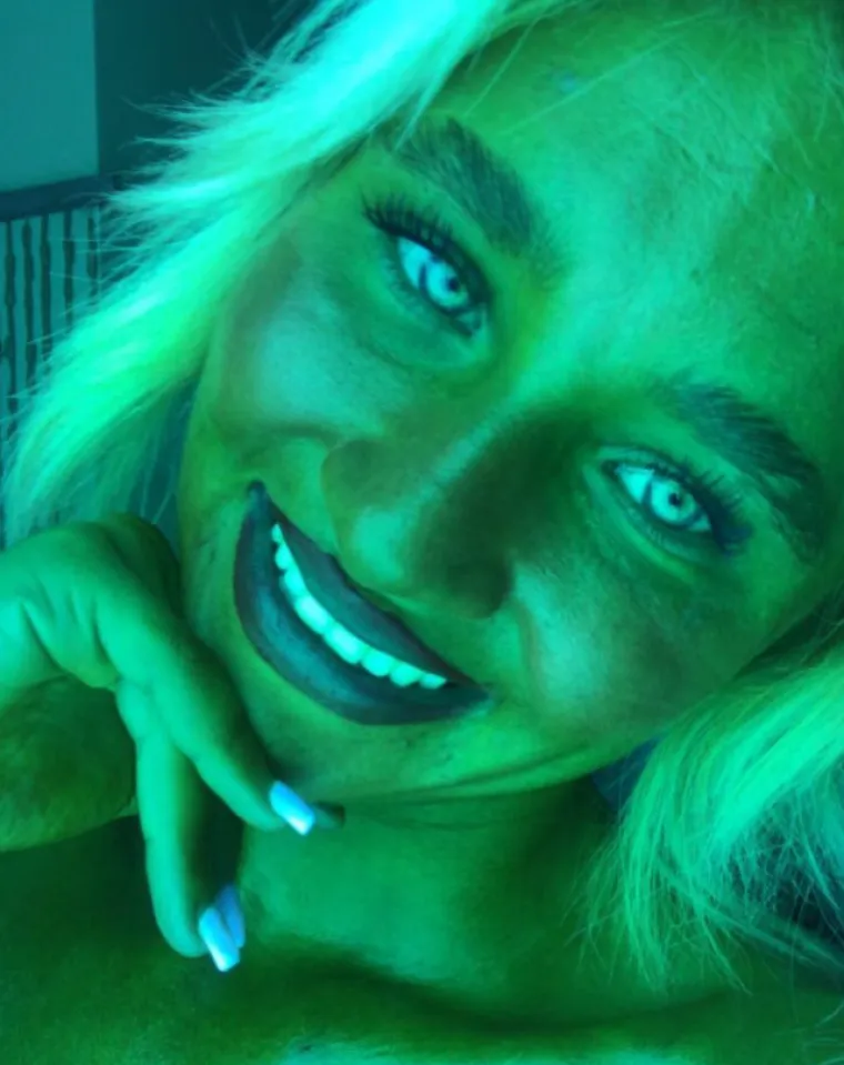 Ovisna je o solariju do te mjere da si je unakazila kožu, a ba&scaron; je bila slatka djevojka