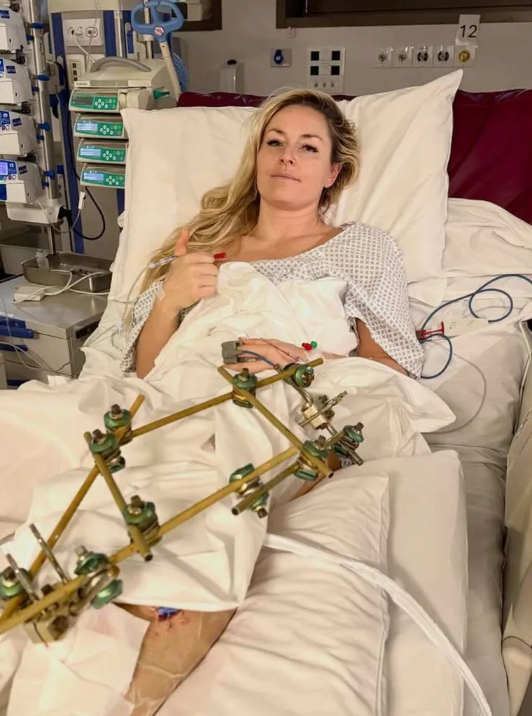 Lindsey Vonn iza&scaron;la pred fotografe u potpuno otkopčanom sakou