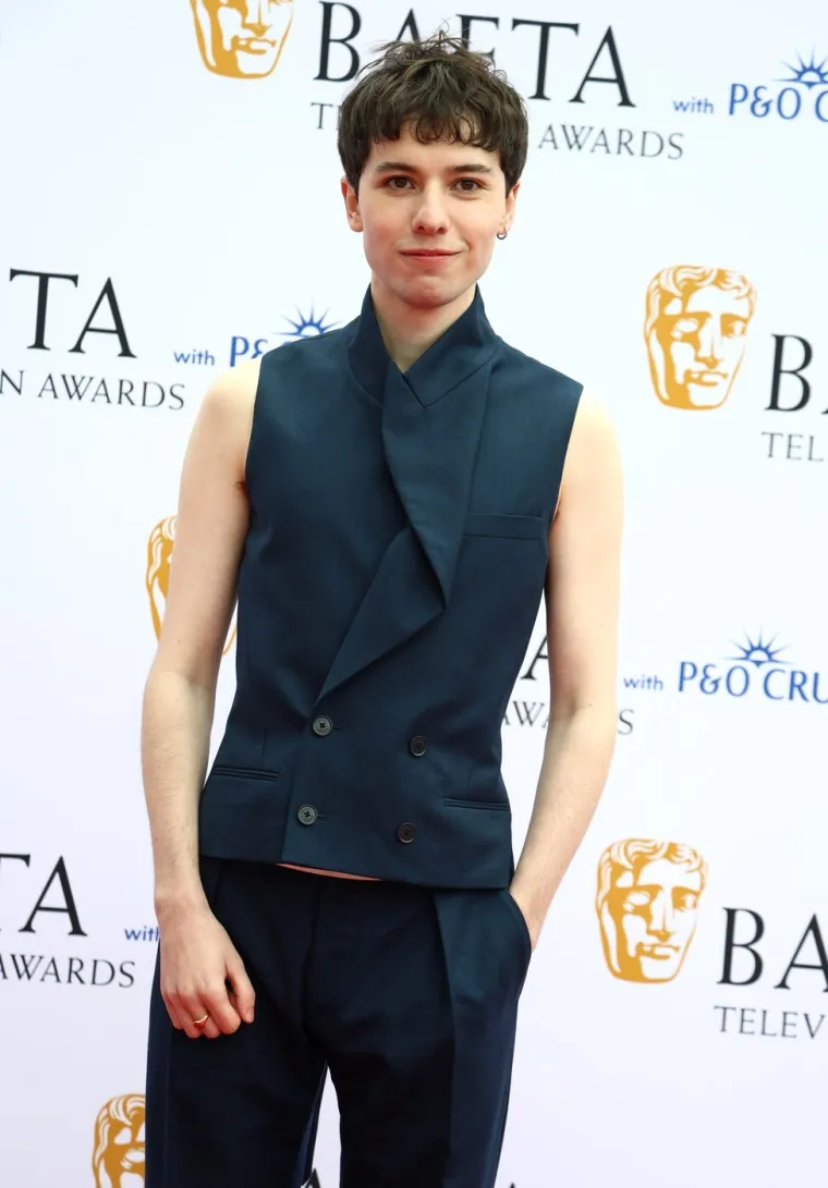 Dekoltei 'na izvol'te' i neukusni &scaron;e&scaron;iri: Jesu li se zvijezde s BAFTA-e pogledale u ogledalo?