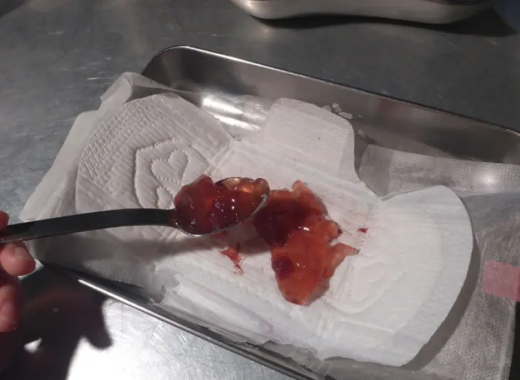 Nevjerojatno na čemu su sve gosti dobili serviranu hranu: Nakon ovoga mnogi su izgubili apetit