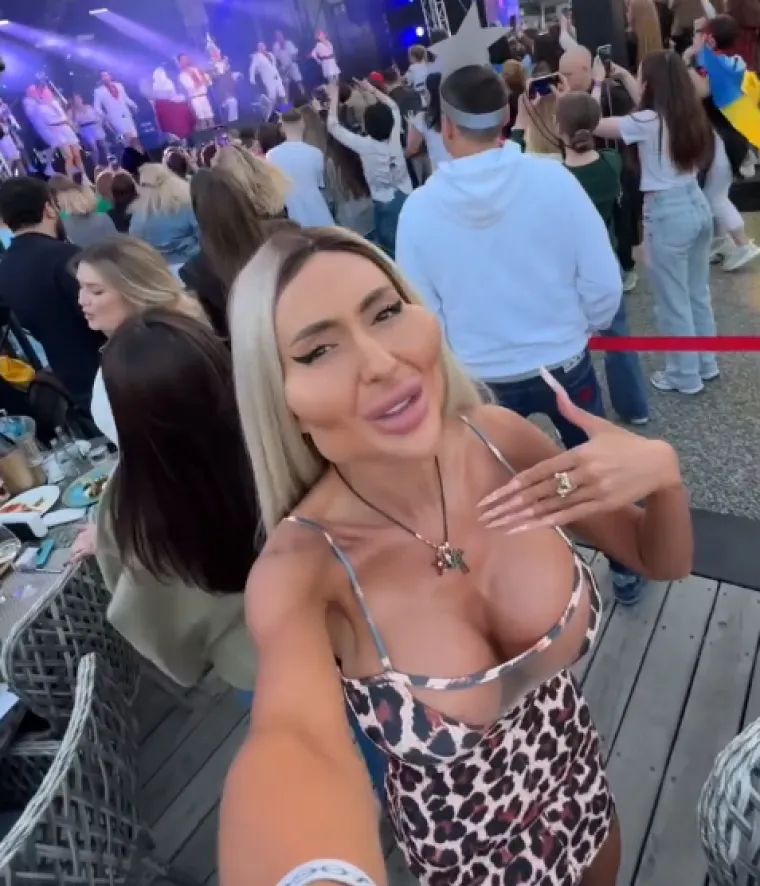 Žena s najvećim obrazima u dugotrajnom je procesu otapanja filera: Promjene su već vidljive