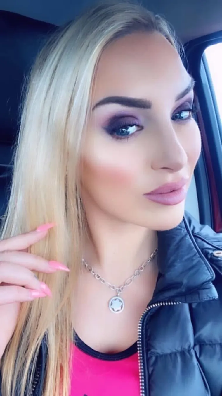 Potro&scaron;ila je bogatstvo da bi bila Barbie: Sada ulaže jo&scaron; vi&scaron;e kako bi vratila prirodan izgled