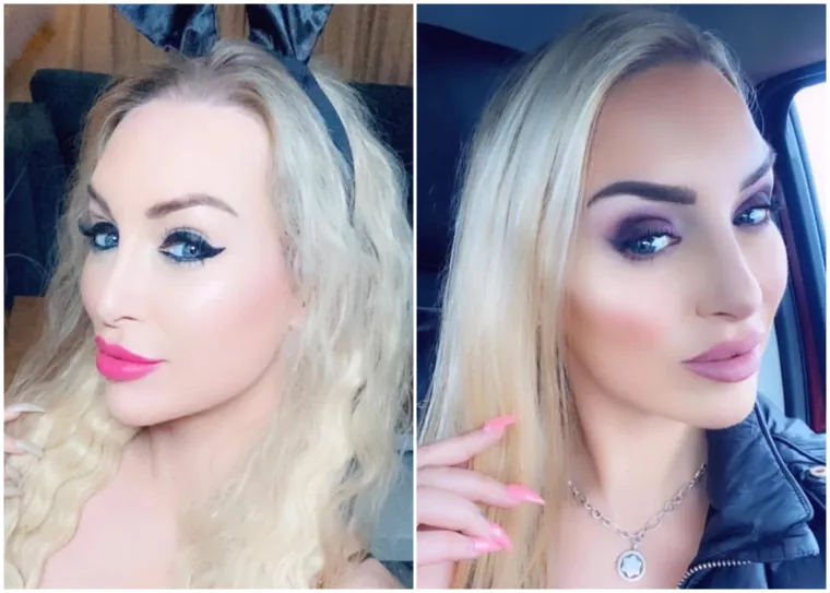 Potro&scaron;ila je bogatstvo da bi bila Barbie: Sada ulaže jo&scaron; vi&scaron;e kako bi vratila prirodan izgled