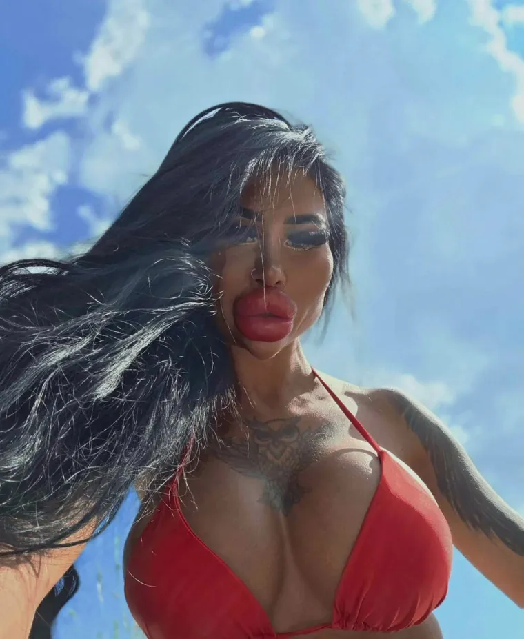 Ne, ovo nije Photoshop: Ljubiteljica estetskih zahvata &scaron;okirala fanove svojim izgledom