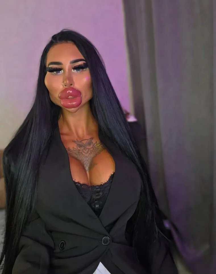 Ne, ovo nije Photoshop: Ljubiteljica estetskih zahvata &scaron;okirala fanove svojim izgledom