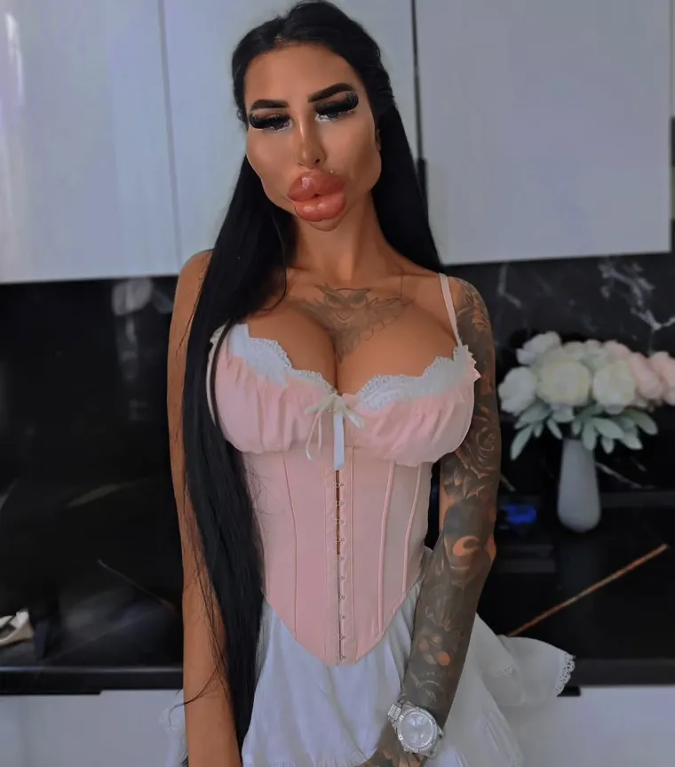 Ne, ovo nije Photoshop: Ljubiteljica estetskih zahvata &scaron;okirala fanove svojim izgledom