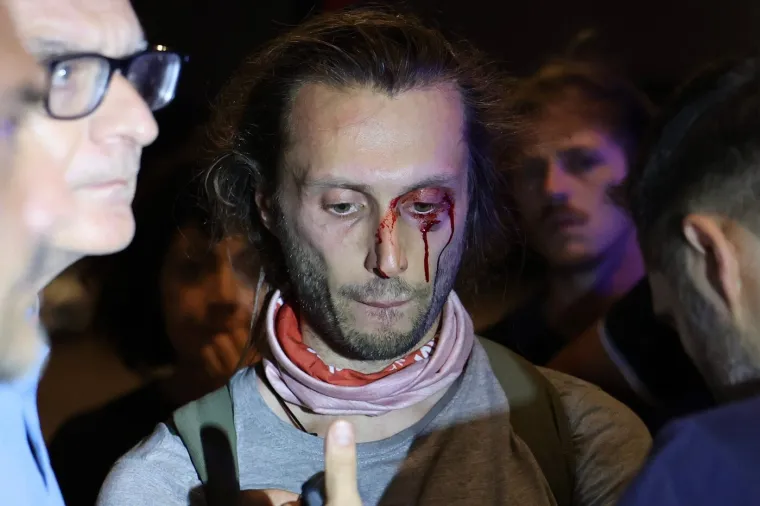 Apsolutno ludilo, kr&scaron; i lom: Bacili eksploziv kod policijske zgrade, uslijedio žestoki sukob