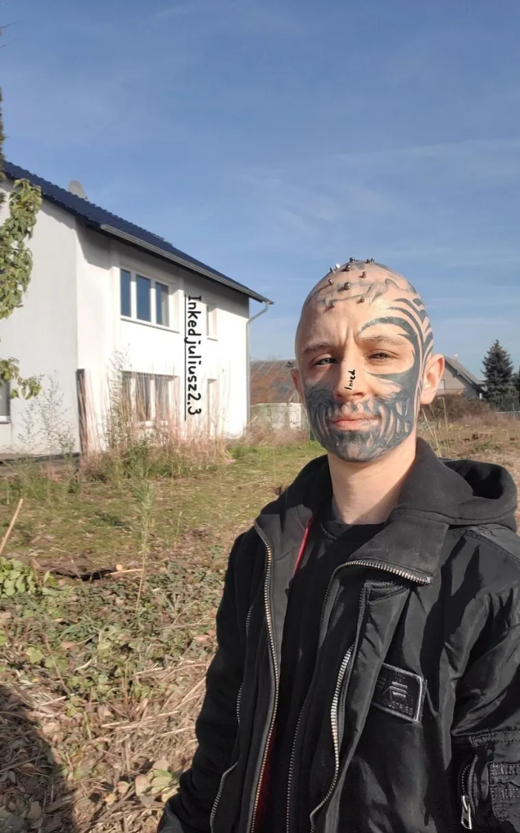 Slijepi mu&scaron;karac s metalom u glavi i crnim očima &scaron;okira pojavom: Evo kako je izgledao prije