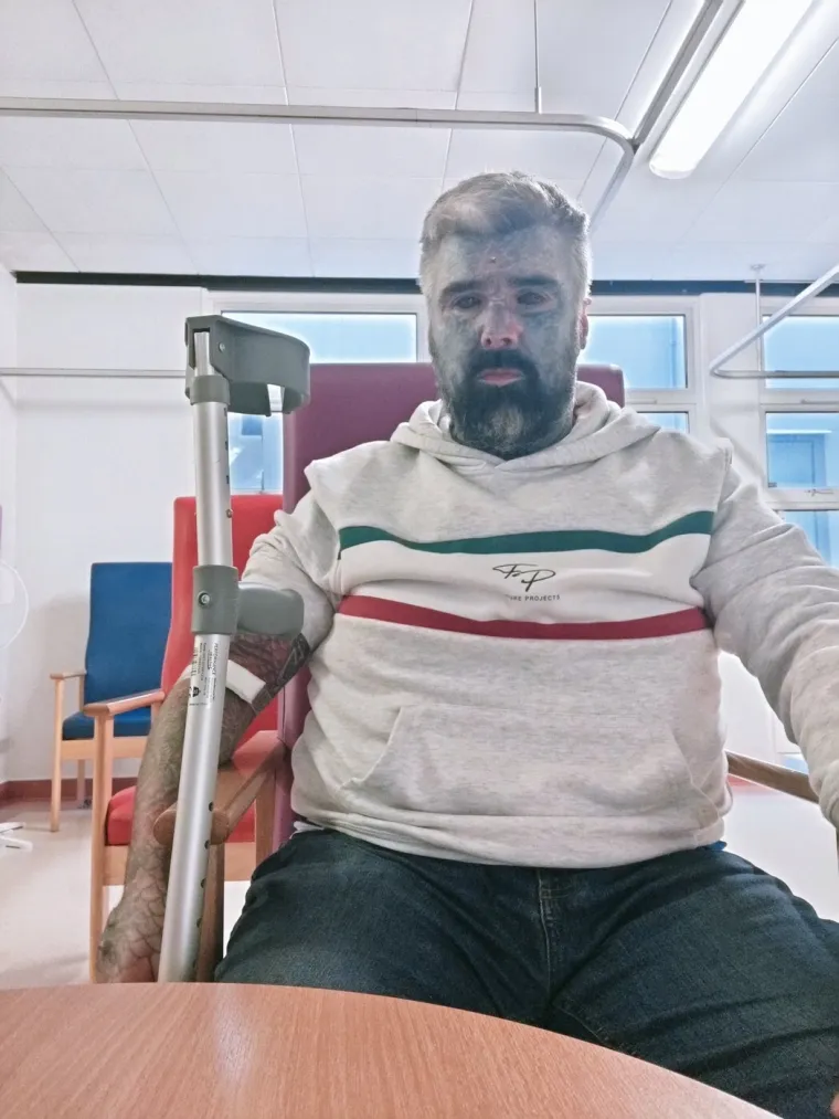 Tetovirao je cijelo tijelo, uključujući i oči, pa iznenada oslijepio: Ne namjerava stati