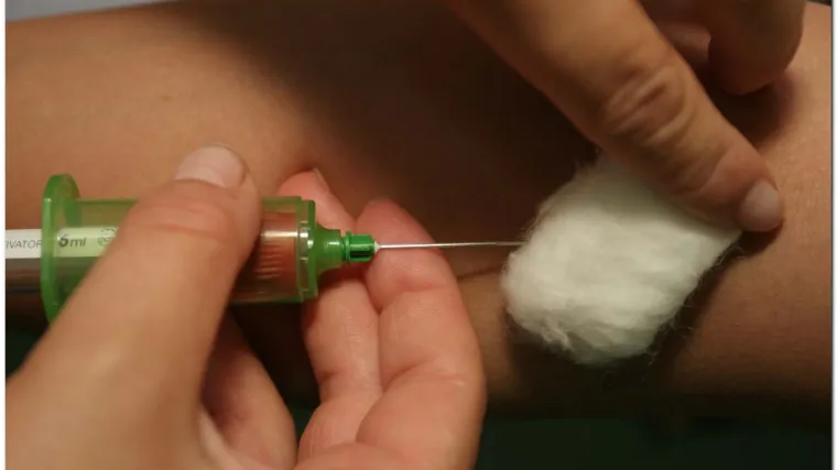 U Hrvatskoj AIDS pod kontrolom