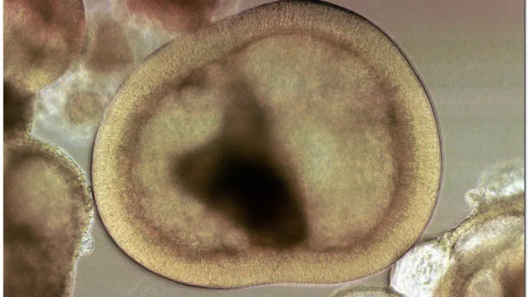 Uskoro lijek za dijabetes i infarkt