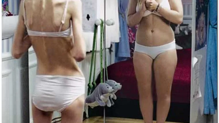 Broj anoreksičnih se udvostručio