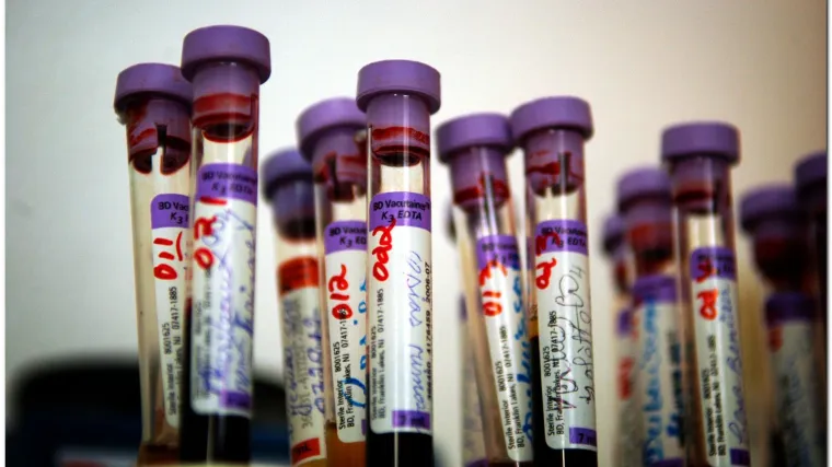 Uzbuna u Washingtonu: Epidemija HIV-a na razini Ugande