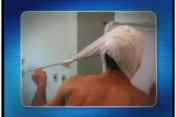 Brazilcu se u podvodnom ribolovu zabio harpun u glavu