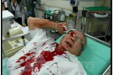 Bangkok: U vođu prosvjednika ispaljeno stotinjak metaka