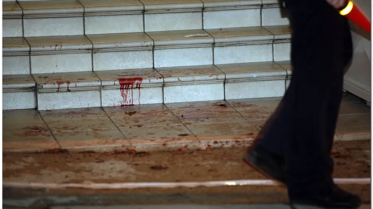 Mladiću iz osvete htjeli odrezati &scaron;ake