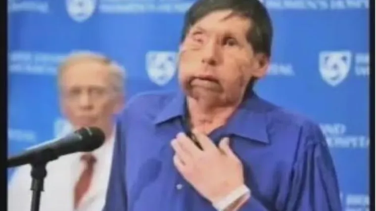 Mu&scaron;karac dobio novo lice