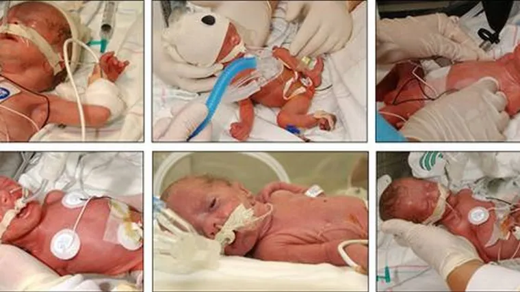 U Belfastu rođene &scaron;estorke