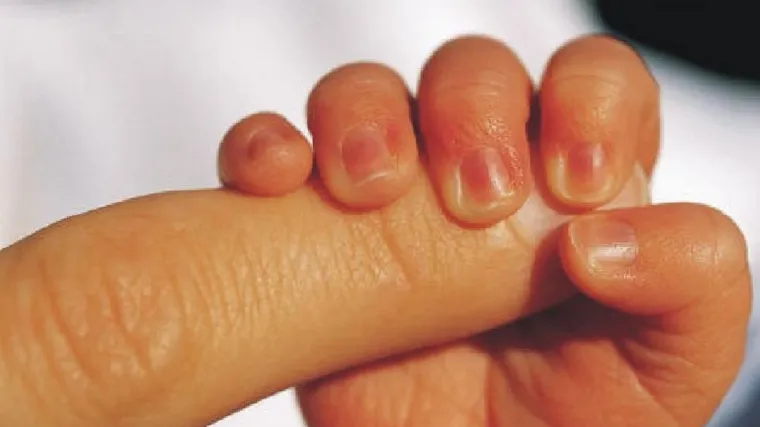 Bez braka nema djeteta