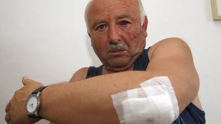 Učenici premlatili drni&scaron;kog profesora