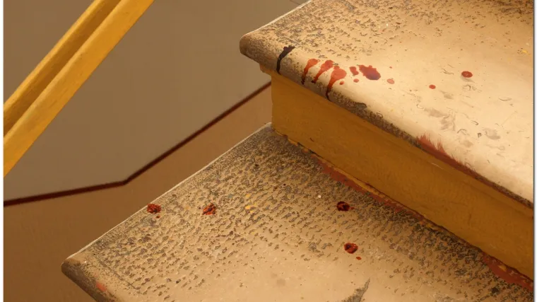 U svađi nožem ubola supruga u prsa