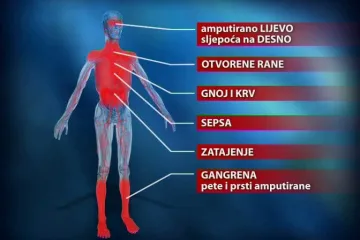 Liječnici: Nismo krivi za Bikićevo stanje!