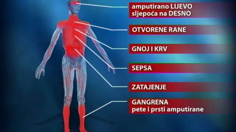 Inspektori češljaju riječki KBC