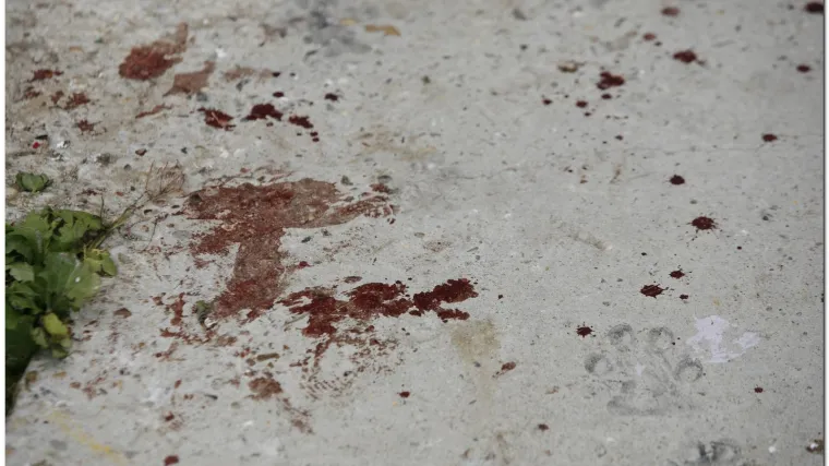 S rasporenim trbuhom u&scaron;etao u bolnicu