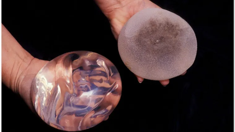 Talijani zabranjuju silikone maloljetnicama