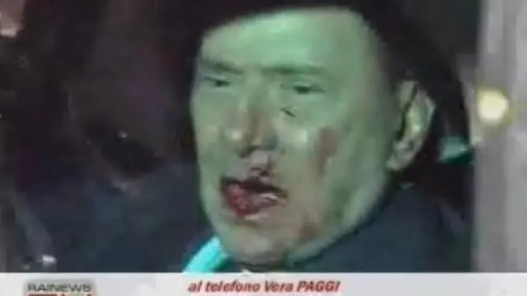 Berlusconija sve boli, ostaje u bolnici