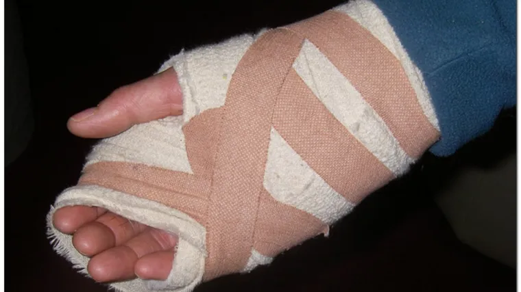 KB Dubrava: Pri&scaron;ili &scaron;aku odsječenu sjekirom