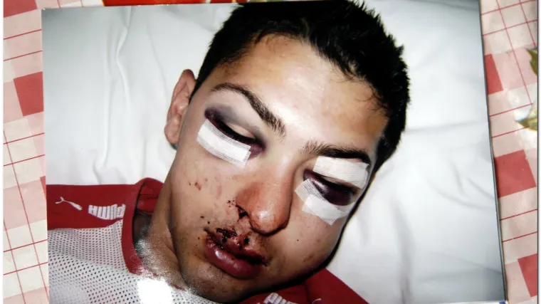 Mladić tvrdi da su ga pretukli pijani policajci