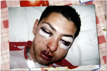 Mladić tvrdi da su ga pretukli pijani policajci