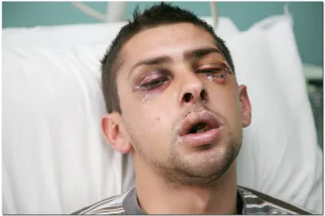 Pogoršano stanje pretučenog mladića