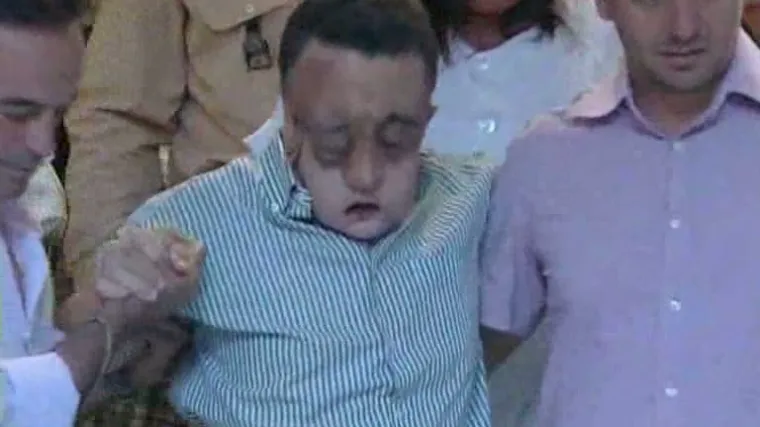 &Scaron;panjolac pokazao presađeno lice