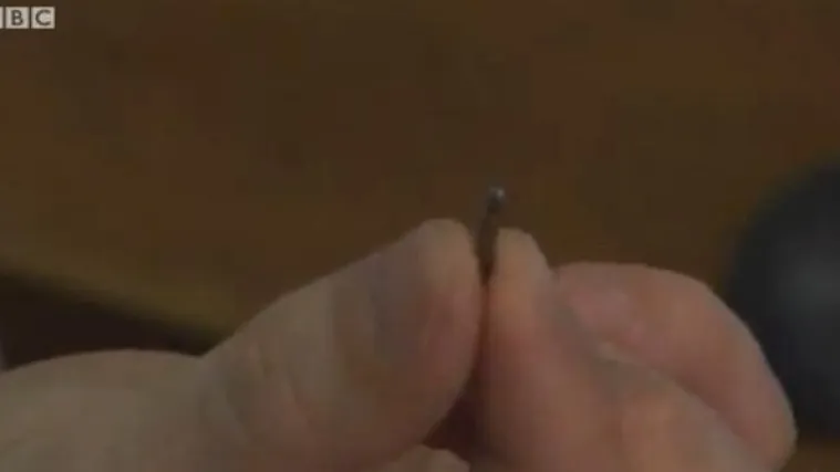 Prvi čovjek zaražen kompjutorskim virusom