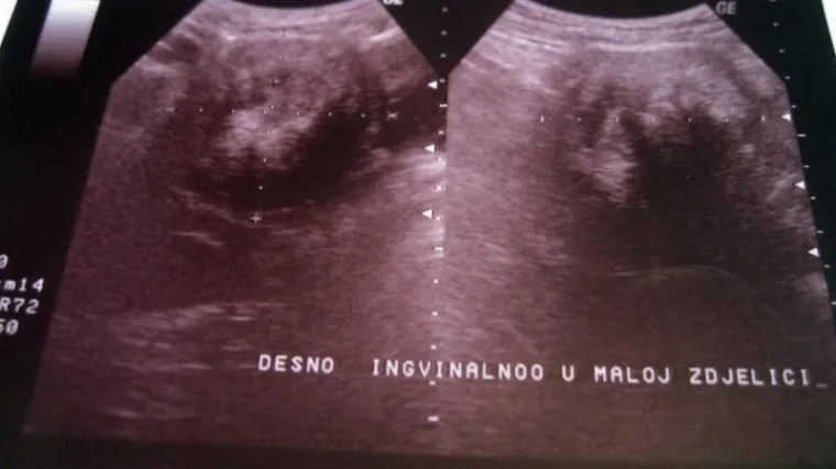 Nobelovac u Splitu: 21 posto tumora uzrokuju infekcije